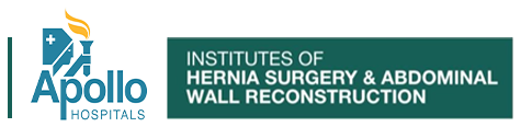 Hernia surgery cost in Chennai | Chennai Hernia Clinic